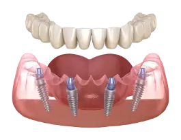 Mitachi Dental Health