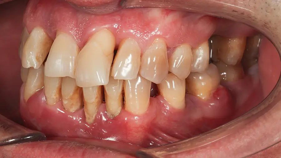 Pacientul a venit la noi cu problema X și Y, împreună cu echipa i-am făcut A,B, C, D