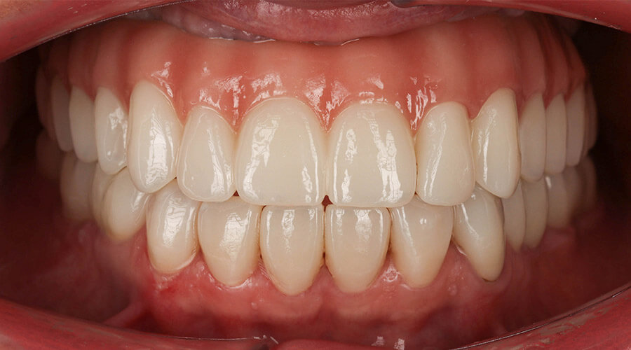 Pacientul a venit la noi cu problema X și Y, împreună cu echipa i-am făcut A,B, C, D