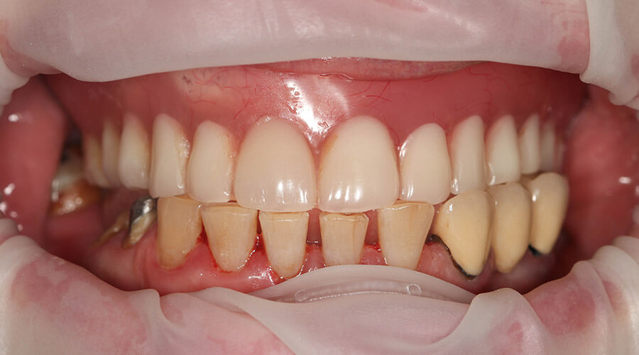 Pacientul a venit la noi cu problema X și Y, împreună cu echipa i-am făcut A,B, C, D