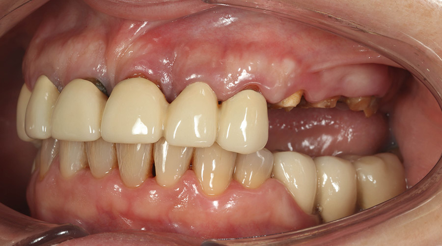 Pacientul a venit la noi cu problema X și Y, împreună cu echipa i-am făcut A,B, C, D