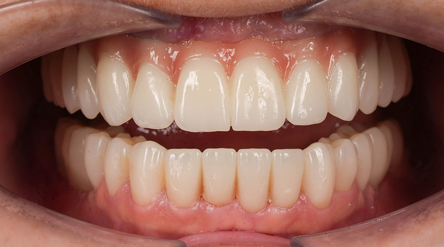 Pacientul a venit la noi cu problema X și Y, împreună cu echipa i-am făcut A,B, C, D