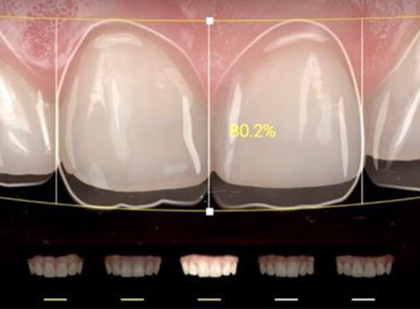 Mitachi Dental Health