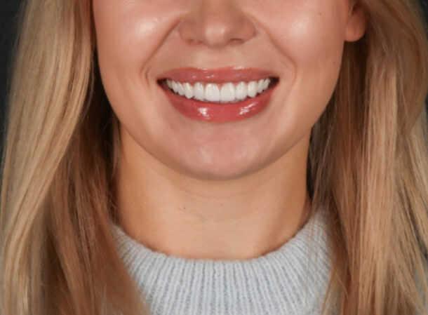 Mitachi Dental Health